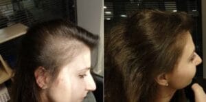 Biotin Hair Growth Essence Spray (Buy 1 Get 1 FREE) photo review